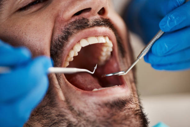 Best Affordable Emergency Dental Care  in Grass Valley, CA